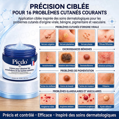 𝐏𝐢𝐜𝐝𝐨® 𝐂𝐫𝐞𝐦𝐞 𝐜𝐨𝐫𝐫𝐞𝐜𝐭𝐫𝐢𝐜𝐞 𝐩𝐨𝐮𝐫 𝐚𝐜𝐫𝐨𝐜𝐡𝐨𝐫𝐝𝐨𝐧𝐬 𝐞𝐭 𝐭𝐚𝐜𝐡𝐞𝐬 𝐜𝐮𝐭𝐚𝐧é𝐞𝐬 (Formule indolore et sans cicatrice) 🎉