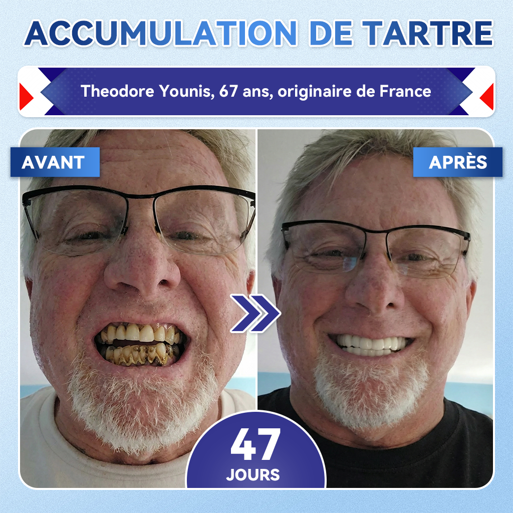 🎁Sourire instantané 🎁 𝐺𝑙𝑖𝑚𝑚𝑒𝑟𝑙𝑦® Tideglusib Dents et gencives Bandes orales réparatrices à dissolution rapide 💎 (Restaure émail/dentine • Renforce gencives • Élimine tartre & odeurs • Blanchit • Fin des sensibilités)