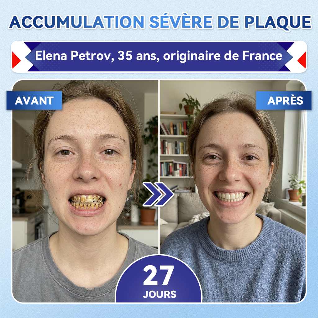 🎁Sourire instantané 🎁 𝐺𝑙𝑖𝑚𝑚𝑒𝑟𝑙𝑦® Tideglusib Dents et gencives Bandes orales réparatrices à dissolution rapide 💎 (Restaure émail/dentine • Renforce gencives • Élimine tartre & odeurs • Blanchit • Fin des sensibilités)