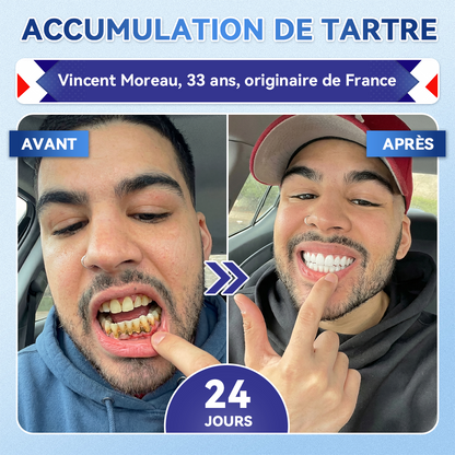 🎁Sourire instantané 🎁 𝐺𝑙𝑖𝑚𝑚𝑒𝑟𝑙𝑦® Tideglusib Dents et gencives Bandes orales réparatrices à dissolution rapide 💎 (Restaure émail/dentine • Renforce gencives • Élimine tartre & odeurs • Blanchit • Fin des sensibilités)
