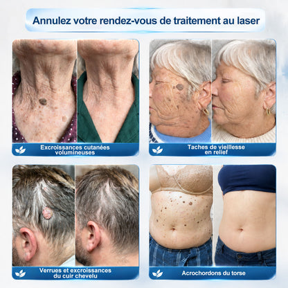 𝐏𝐢𝐜𝐝𝐨® 𝐒𝐨𝐥𝐮𝐭𝐢𝐨𝐧 𝐜𝐢𝐛𝐥é𝐞 𝟕 𝐣𝐨𝐮𝐫𝐬 𝐩𝐨𝐮𝐫   𝐚𝐜𝐫𝐨𝐜𝐡𝐨𝐫𝐝𝐨𝐧𝐬 𝐞𝐭 𝐢𝐦𝐩𝐞𝐫𝐟𝐞𝐜𝐭𝐢𝐨𝐧𝐬(Roll-on indolore et sans trace) ❤️