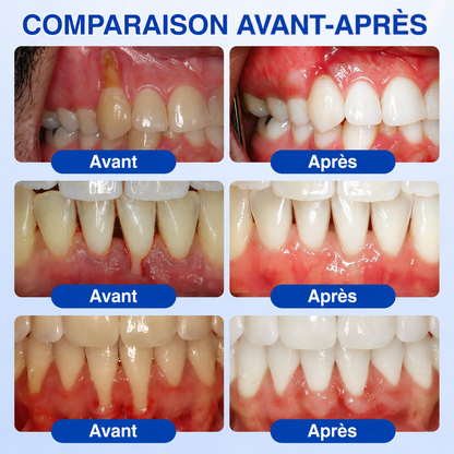 🇫🇷 𝑮𝒍𝒊𝒎𝒎𝒆𝒓𝒍𝒚® 𝑮𝒖𝒎𝑹𝒆𝒗𝒊𝒗𝒆 𝑮𝒆𝒍 𝒅𝒆 𝑹é𝒑𝒂𝒓𝒂𝒕𝒊𝒐𝒏 𝑷𝒂𝒓𝒐𝒅𝒐𝒏𝒕𝒂𝒍𝒆