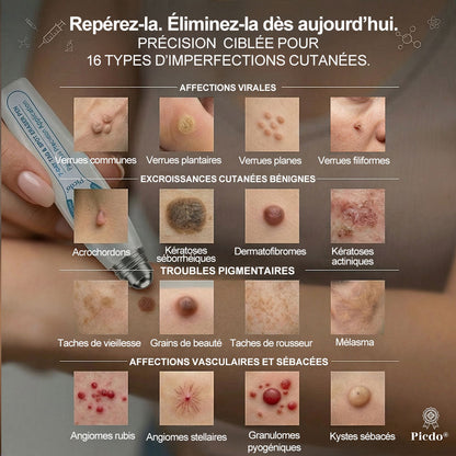 𝐏𝐢𝐜𝐝𝐨® 𝐒𝐨𝐥𝐮𝐭𝐢𝐨𝐧 𝐜𝐢𝐛𝐥é𝐞 𝟕 𝐣𝐨𝐮𝐫𝐬 𝐩𝐨𝐮𝐫   𝐚𝐜𝐫𝐨𝐜𝐡𝐨𝐫𝐝𝐨𝐧𝐬 𝐞𝐭 𝐢𝐦𝐩𝐞𝐫𝐟𝐞𝐜𝐭𝐢𝐨𝐧𝐬(Roll-on indolore et sans trace) ❤️