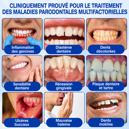 🇫🇷 𝑮𝒍𝒊𝒎𝒎𝒆𝒓𝒍𝒚® 𝑮𝒖𝒎𝑹𝒆𝒗𝒊𝒗𝒆 𝑮𝒆𝒍 𝒅𝒆 𝑹é𝒑𝒂𝒓𝒂𝒕𝒊𝒐𝒏 𝑷𝒂𝒓𝒐𝒅𝒐𝒏𝒕𝒂𝒍𝒆