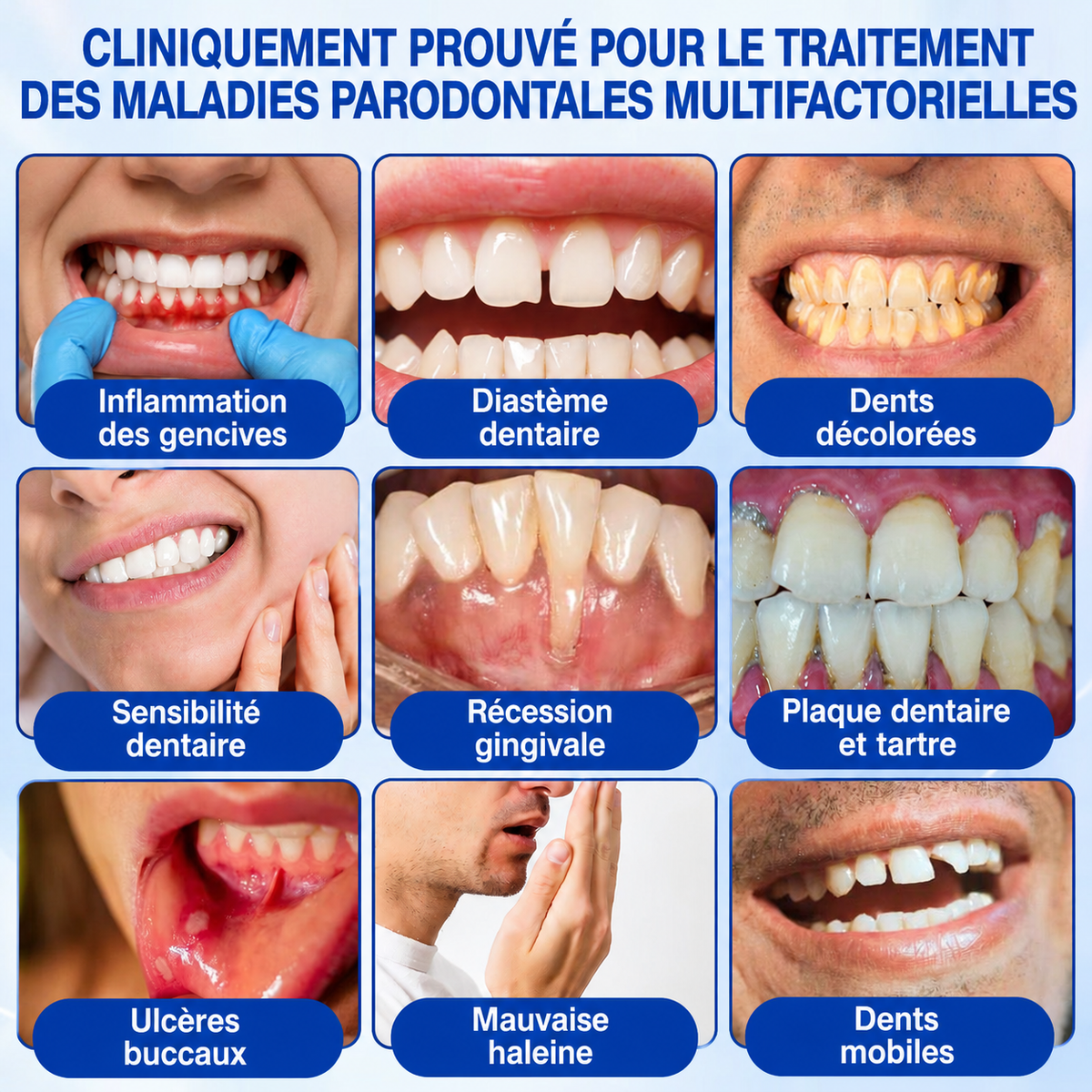 🇫🇷 𝑮𝒍𝒊𝒎𝒎𝒆𝒓𝒍𝒚® 🧑‍⚕️ 𝑮𝒖𝒎𝑹𝒆𝒗𝒊𝒗𝒆 𝑮𝒆𝒍 𝒅𝒆 𝑹é𝒑𝒂𝒓𝒂𝒕𝒊𝒐𝒏 𝑷𝒂𝒓𝒐𝒅𝒐𝒏𝒕𝒂𝒍𝒆 ❤️