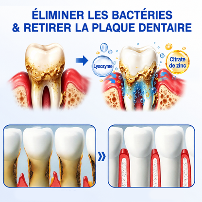 🇫🇷 𝑮𝒍𝒊𝒎𝒎𝒆𝒓𝒍𝒚® 🧑‍⚕️ 𝑮𝒖𝒎𝑹𝒆𝒗𝒊𝒗𝒆 𝑮𝒆𝒍 𝒅𝒆 𝑹é𝒑𝒂𝒓𝒂𝒕𝒊𝒐𝒏 𝑷𝒂𝒓𝒐𝒅𝒐𝒏𝒕𝒂𝒍𝒆 ❤️