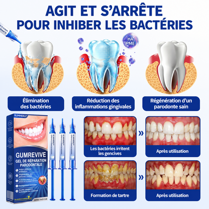 🇫🇷 𝑮𝒍𝒊𝒎𝒎𝒆𝒓𝒍𝒚® 🧑‍⚕️ 𝑮𝒖𝒎𝑹𝒆𝒗𝒊𝒗𝒆 𝑮𝒆𝒍 𝒅𝒆 𝑹é𝒑𝒂𝒓𝒂𝒕𝒊𝒐𝒏 𝑷𝒂𝒓𝒐𝒅𝒐𝒏𝒕𝒂𝒍𝒆 ❤️